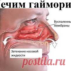 Народные советы — Картинки из тем | OK.RU Фотоальбом Картинки из тем группы Народные советы в Одноклассниках