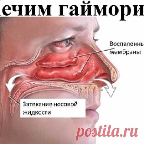 Народные советы — Картинки из тем | OK.RU Фотоальбом Картинки из тем группы Народные советы в Одноклассниках