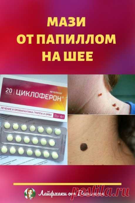 Папилломы и Бородавки - преимущественно доброкачественные новообразования кожи, зачастую вирусного происхождения. Возникают в виде узелка или сосочка. Вызываются вирусом папилломы человека (ВПЧ). Могут перерождаться в меланому - неизлечимый рак кожи.
