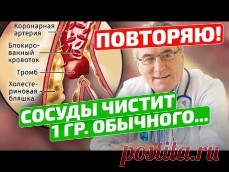 Старый флеболог: Смотрите, как я легко чищу сосуды от бляшек и тромбов!