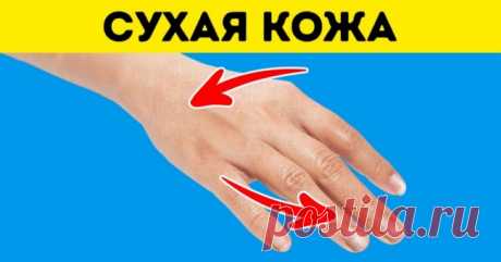 7 признаков болезни щитовидной железы, которые мы не замечаем | Милая Я Щитовидная железа отвечает за выработку гормонов, которые регулируют обмен веществ (метаболизм), температуру и пульс. Если ее работа нарушена, это может грозить серьезными последствиями для наших органов, включая печень, кишечник, почки, репродуктивную систему, сердце и даже мозг. Сегодня Milayaya.ru расскажет, на какие симптомы стоит обратить внимание, чтобы избежать серьёзных проблем со здоровьем. Ус...