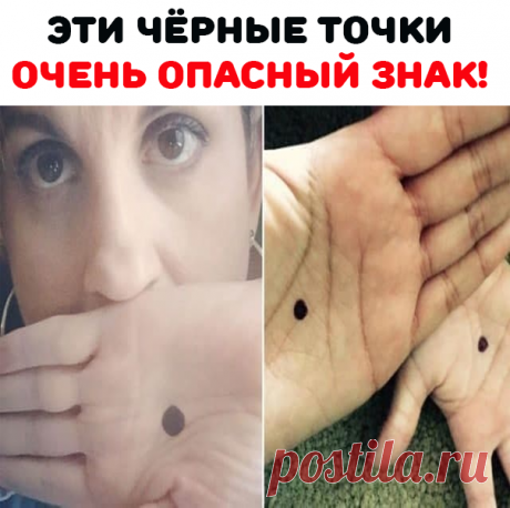 Кампания «черная точка» была создана на Facebook. Ее цель — помочь разыскивать жертв домашнего насилия. Черная точка на ладони — это символ, который является безмолвным криком о помощи.

С помощью такого знака жертвы домашнего насилия могут обратить на себя внимание и указывают, что они находятся в серьезной опасности. Они взывают о помощи и надеются, что будут спасены от обидчика. Если вы увидели кого-то с черной точкой на руке, вы можете помочь человеку, немедленно позвонив в полицию.