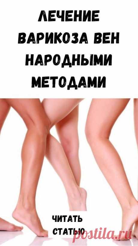 Лечение варикоза вен народными методами