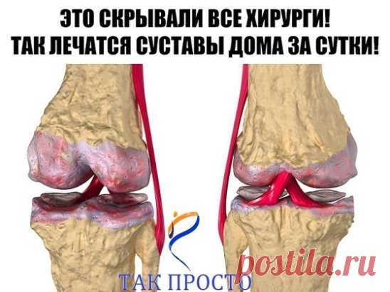 Это скрывали все хирурги! Так лечатся суставы дома за сутки 
Эта микстура «скорая помощь» от боли в суставах. 
Такая микстура должна быть в каждом доме. 
Ингредиенты: 
1 сл. ложка крупной соли, 
1 литр воды, 
нашатырный спирт, 
камфорное масло. 
Всыпьте 1 ст. ложку соли крупного помола в 1 л воды и размешайте. Отдельно возьмите 80-100 мл 10 %-го нашатырного спирта и влейте туда 10 г камфорного спирта. Смесь взболтайте и соедините с солевым раствором. Появятся белые хлопья. Закройте емкость кр
