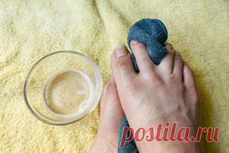 Лечение грибка ногтей уксусом в домашних условиях