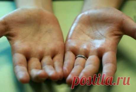 Потливость ладоней, причины, симптомы, лечение потливости рук Причины сильной потливости рук, симптомы, какие заболевания вызывают повышенную потливость ладоней. Средства против пота, лечение гипергидроза, народные методы.