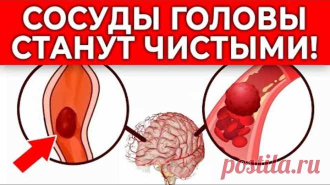 Пей ЭТО от головной боли! Сосуды головы станут ЧИСТЫМИ! | 3 способа очистить сосуды
