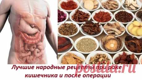 Народные рецепты от рака кишечника Доброе время суток! Меня зовут Халисат Сулейманова - я фитотерапевт. В 28 лет себя вылечила от рака матки травами (больше про мой опыт выздоровления и почему я стала фитотерапевтом читайте здесь: Моя история). Перед тем как лечиться по народным методам описанным в интернете, просьба, консультируйтесь со специалистом и лечащим врачом! Это сэкономит ваше время и деньги, поскольку заболевания … Читать далее Рак кишечника после операции лечение народными средствами