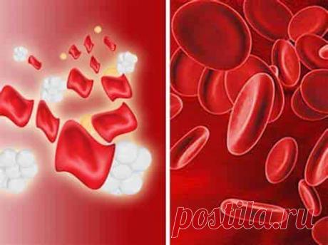 Талассемия  (код МКБ-10; код МКБ-11): описание, причины, симптомы, как лечить | Клиника лечения боли: врачи онлайн