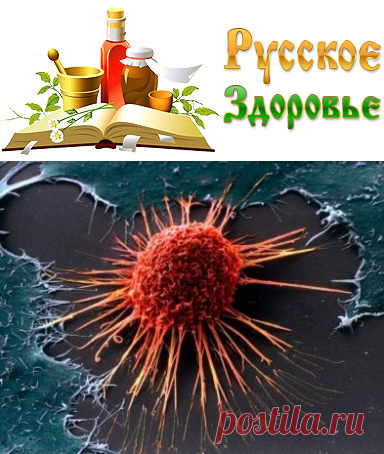 Почему людей поражает рак?