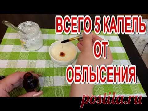 Всего 5 Капель этого Простого Средства! При Облысении! Рост Быстрых Волос!