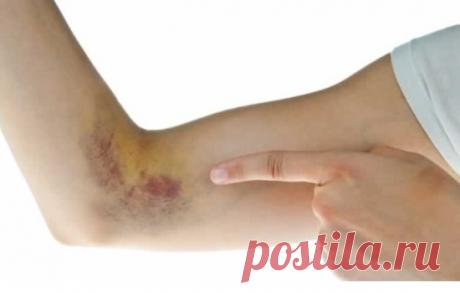 9 ранних предупреждающих симптомов того, что у вас в организме низкий уровень витамина C - Журнал для женщин Обратите внимание! Витамин С является важным питательным веществом, которое защищает организм от любых недостатков иммунной системы. Орган требует регулярных доз этого витамина для профилактики как общей болезни, так и серьезных проблем со здоровьем. К сожалению, большинству людей этого недостаточно. 9 ранних предупреждающих симптомов того, что у вас в организме низ...