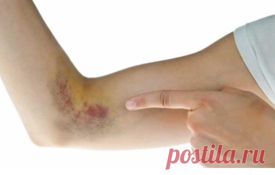 9 ранних предупреждающих симптомов того, что у вас в организме низкий уровень витамина C - Журнал для женщин Обратите внимание! Витамин С является важным питательным веществом, которое защищает организм от любых недостатков иммунной системы. Орган требует регулярных доз этого витамина для профилактики как общей болезни, так и серьезных проблем со здоровьем. К сожалению, большинству людей этого недостаточно. 9 ранних предупреждающих симптомов того, что у вас в организме низ...