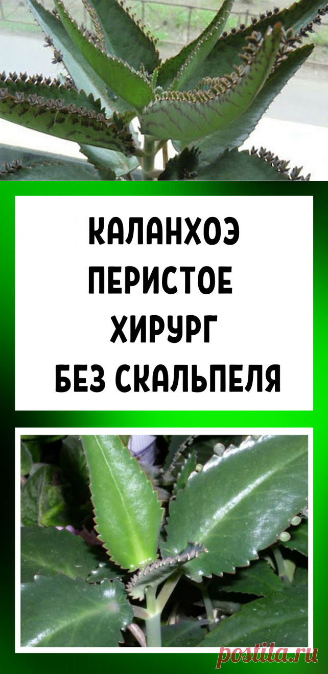 Каланхоэ перистое — хирург без скальпеля