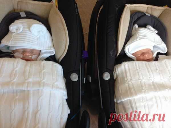 Редчайший случай! Эти близнецы родились с удивительной особенностью