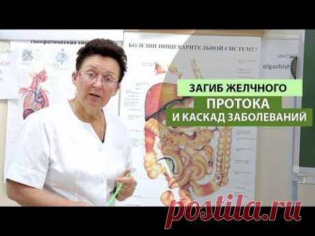 Загиб желчного протока и каскад заболеваний