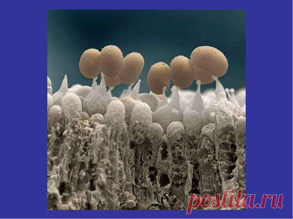 Людей ест не рак! - а грибы-слизевики. Эту информацию ,ревностно охраняет Минздрав. Такой жуткий вывод сделала Лидия Васильевна Козьмина, врач-лаборант с университетским образованием, которая четверть века рассматривала 
под микроскопом возбудителей всевозможных болезней у своих пациентов. 
Она обнаруживала в крови людей со странными, атипичными заболеваниями 
микоплазмы, хламидии, трихомонады и… НЕЧТО ПОХОЖЕЕ НА ГРИБНИЦУ, 
нити которой состоят… ИЗ ОДНОКЛЕТОЧНЫХ ПАРАЗИТОВ ...