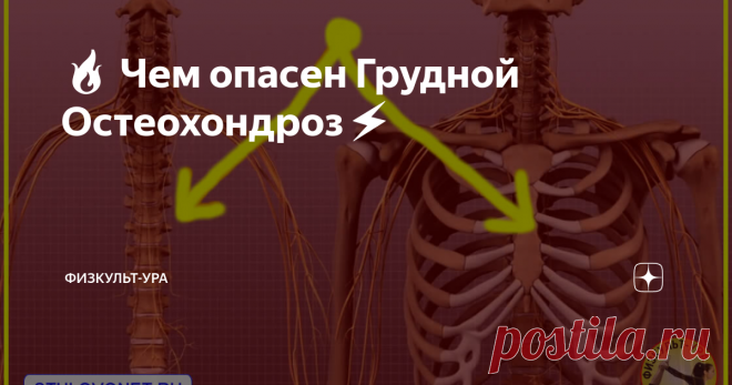 🔥 Чем опасен Грудной Остеохондроз⚡️ 👉Тем, что может развиться целый 