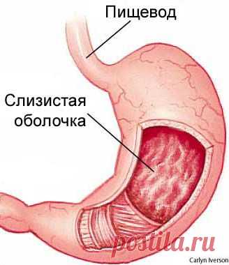 АЛОЭ С МЁДОМ, А ТАКЖЕ «СТРЕПТОЦИД» ПОЗВОЛИЛИ ЗНАКОМОЙ ОБУЗДАТЬ ГАСТРИТ | Советы Народной Мудрости