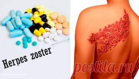 Причины развития герпеса - Народная медицина - медиаплатформа МирТесен Опоясывающий герпес – это заболевание, которое, как правило, поражает людей в возрасте старше 50 лет или тех, у кого сильно ослаблена иммунная система. Опоясывающий герпес, или лишай — это инфекция, вызванная вирусом ветряной оспы. Это заболевание поражает, главным образом, нервы, находящиеся под