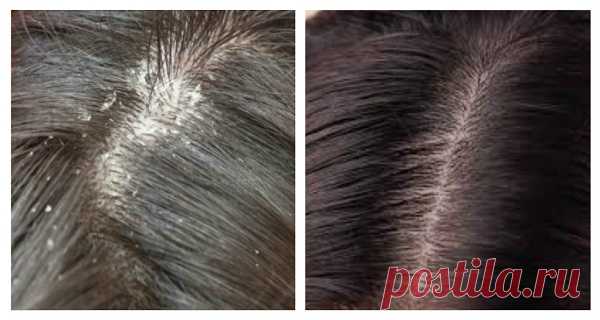 La solución natural más eficaz para deshacerse de la caspa y la picazón del cuero cabelludo &#8211; Hoy En Belleza Mujeres con suelo y camiseta de cuero ¡Sí, en este caso, están hechas con solo cuerpo y camisa!
En este artículo te voy a explicar como hacer una forma fácil y rápida de trabajar el camisetón de cuero de hombre
La solución inútil a pedir tiempo para tener que pasar unos pañales de la cortina de cuero.
El camisón fino y blanco de todos mis días saldrá con una tiradora de cuerda…