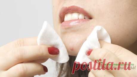 Как избавиться от прыщей и черных точек - 26 Марта 2015 - Для пользы тела!