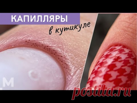 АЖ КАПИЛЛЯРЫ ВИДНО 🙀 Маникюр на тонкой коже. СТЕМПИНГ ПОД КУТИКУЛУ 💅 Рабочие ЛАЙФХАКИ стемпинга