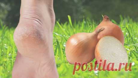 Простой рецепт от трескающихся пяток "намазал-смыл", после которого ноги как у девочки