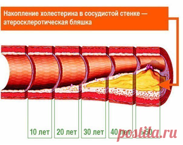 Проверенные поколениями народные средства для сосудов..