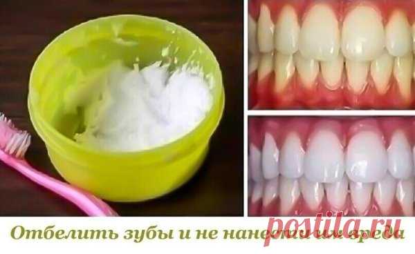 Данный метод помогает практически при любых заболеваниях десен и при этом почти моментально отбеливает зубы, растворяет камень и залечивает маленькие ранки во рту.
Ингредиенты:
- 0,5 ч.л. питьевой соды добавить
- 10-20 капель перекиси водорода (аптечной)
- несколько капель лимона.
В соду добавить перекись водорода и сок лимона. Паста готова!
Ватку обмакиваем в пасту и натираем пастой зубы и десны снаружи и изнутри.
Лимон нейтрализует соду и придает свежесть, сода - очищает...