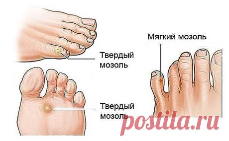 ПОЛЕЗНЫЕ СОВЕТЫ :