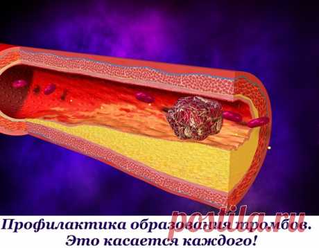 Профилактика образования тромбов