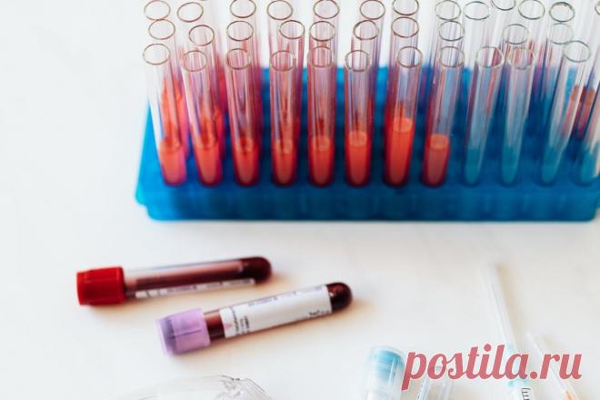 Мочевая кислота — значимый фактор сердечно-сосудистых заболеваний. Почему нужно контролировать ее уровень?
  Мочевая кислота Сердечно-сосудистые заболевания остаются главной причиной убыли населения во всем мире, включая нашу страну. Всем известны основные факторы риска развития этой патологии, включая вредные привычки, низкую двигательную активность, избыточное потребление соли, ожирение,...
Читай дальше на сайте. Жми подробнее ➡