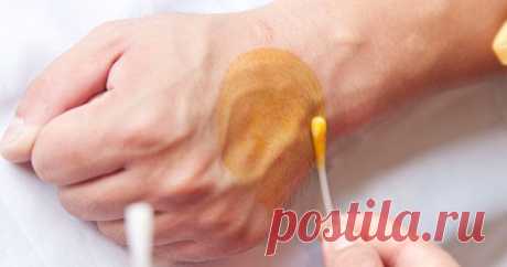 Я не знала, что йод так полезен для женского организма! Поразительный эффект заметили все!