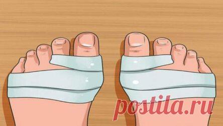 Всего 2 копеечных ингредиента и косточка больше не болит! - Идеи на любой случай Помню, как однажды на уроке биологии мы изучали что-то связанное с генетикой, и учительница рассказывала нам о том, какие генетические заболевания передаются по наследству. В качестве яркого примера она привела косточку на ноге. Увеличенная косточка, некрасивая и болезненная, как подробно расписывала преподавательница, передается по наследству по женской линии. Если у вашей мамы или бабушки было […]