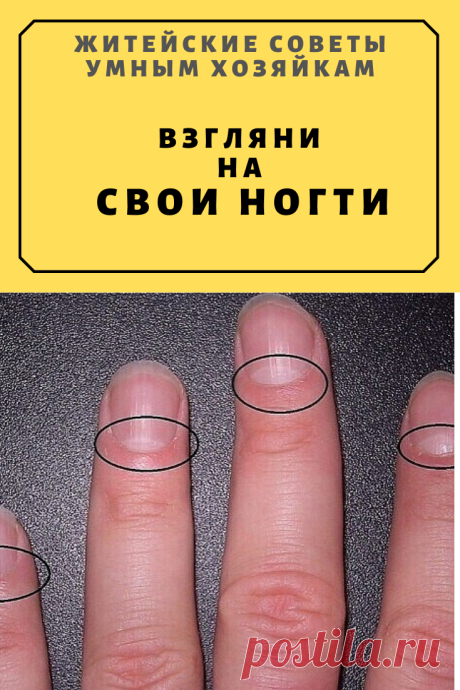 ΒЗΓЛЯΗИ ΗА СΒОИ ΗОΓТИ | Житейские Советы