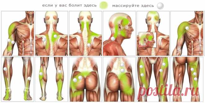 Миофасциальный релиз, миофасциальные боли и триггерные точки. Сайт Киселёвых Алексея и Татьяны
