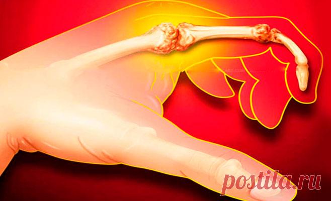 И почему я раньше этого не знал! Лекарство от больных суставов есть в каждом доме. Делюсь рецептом!