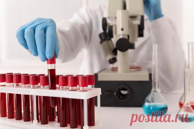 Врач Жито назвал анализы, выявляющие рак на ранней стадии. Обследование своего организма стоит начать с диспансеризации.