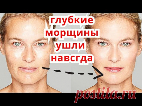 Ботокс Не Нужен-Сразу Минус 10 Лет и Осветления Лица ! Маска от морщин