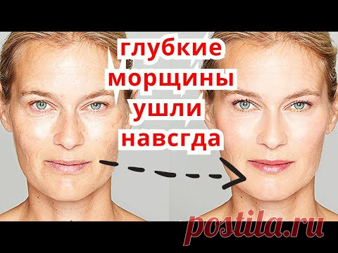 Ботокс Не Нужен-Сразу Минус 10 Лет и Осветления Лица ! Маска от морщин