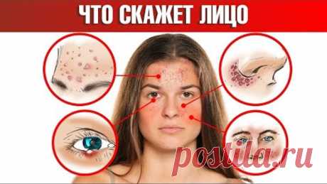 Болезни налицо. 18 признаков, которые расскажут о проблемах