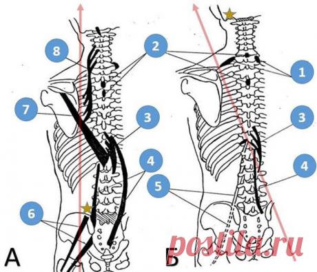 Неспецифические рефлекторно-мышечные синдромы при патологии двигательной системы (лекция). Часть 1: Нейрофизиологические предпосылки и концептуальные модели - Статьи по специальности Неврология и нейрохирургия на портале Medlinks.ru