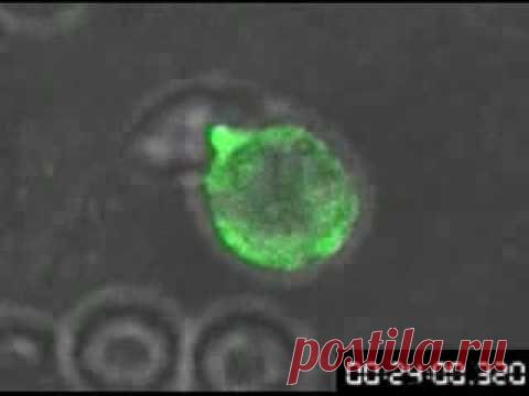 Мифы и правда о ВИЧ-инфекции / Будьте здоровы