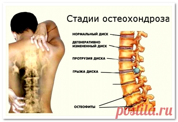 Гимнастика Бутримова нормализует кровообращение и восстановит правильное положение позвонков шеи