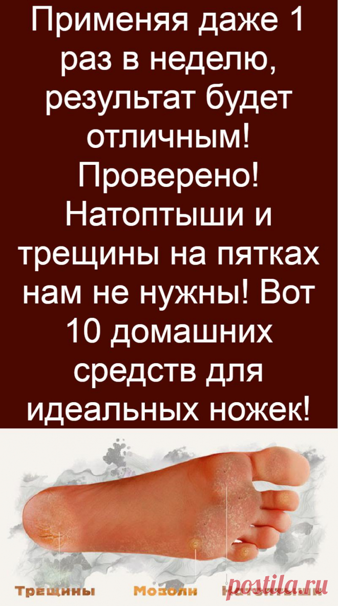 Применяя даже 1 раз в неделю, результат будет отличным! Проверено! Натоптыши и трещины на пятках нам не нужны! Вот 10 домашних средств для идеальных ножек!