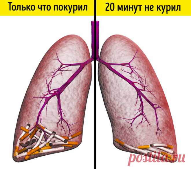20+ неожиданных изменений произойдут в организме, если отказаться от сигарет хотя бы на 2 недели