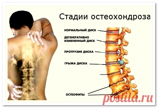 Сенсация! Гимнастика Бутримова нормализует кровообращение и восстановит правильное положение позвонков шеи | Naget.Ru