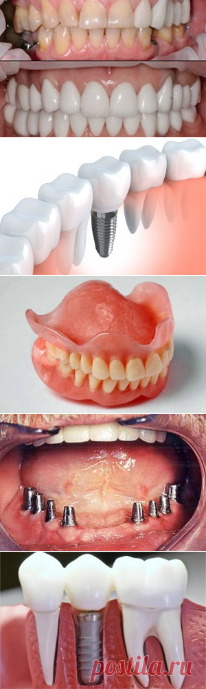 Ортопедия зубов в стоматологии Химки недорогие цены | MEDIVEL