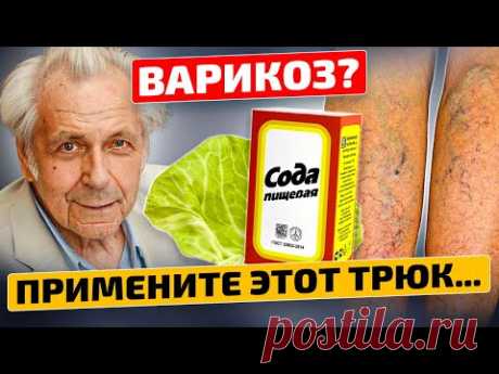 Жаль, что люди позабыли про метод Неумывакина от варикоза